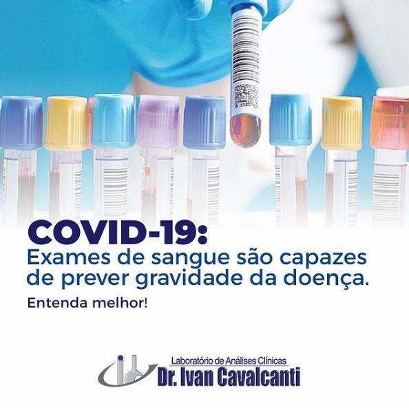 COVID 19 Exames de sangue sao capazes de preever gravidade da doenca